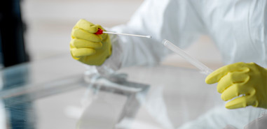 Coronavírus: 5 respostas sobre testes de Covid-19
